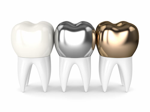 Effective Ways to Deal with Pain in Temporary Dental Crowns