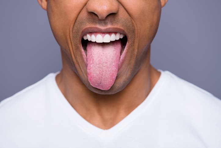 swollen taste buds side of tongue