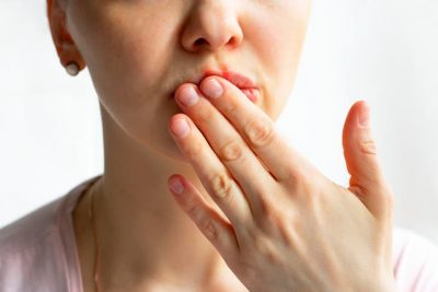 How to Deal with Wounds or Cuts in Your Mouth